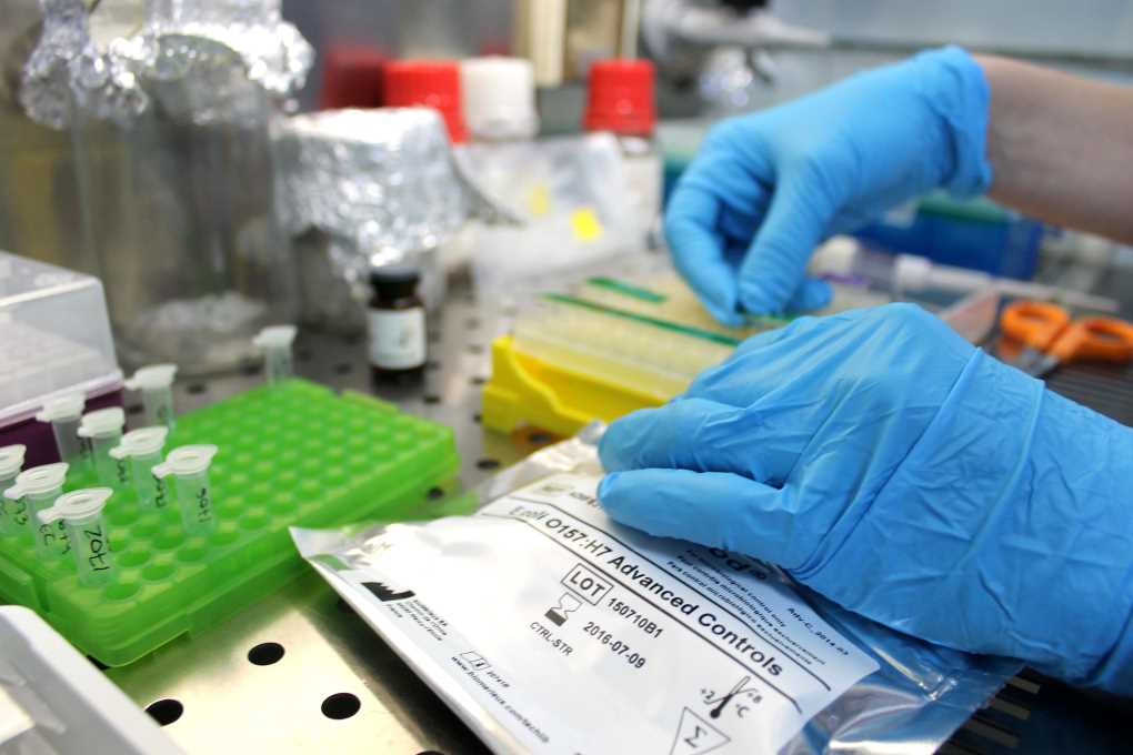 Controles de seguridad alimentaria