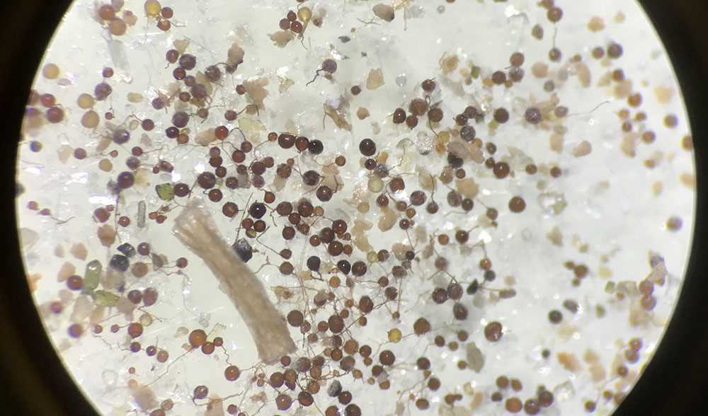 microorganismos