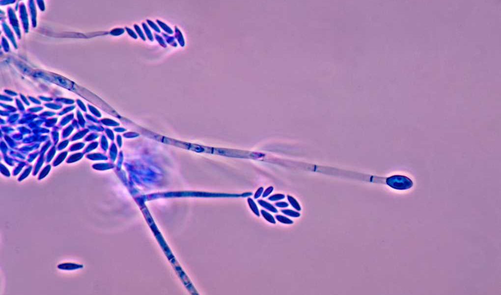 Proyecto SUPERA-1 fusarium