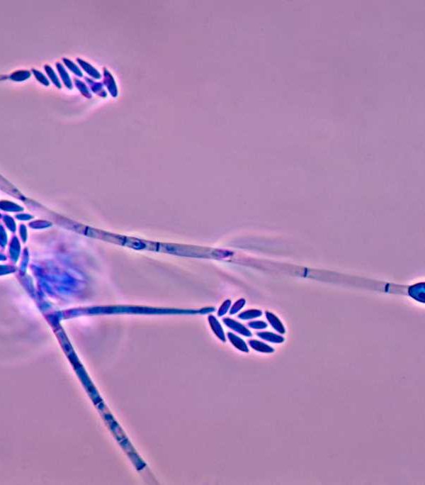 Proyecto SUPERA-1 fusarium