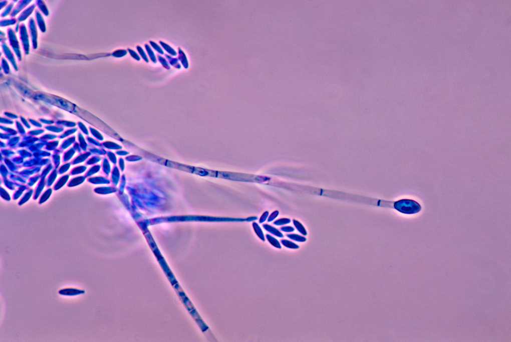 Proyecto SUPERA-1 fusarium