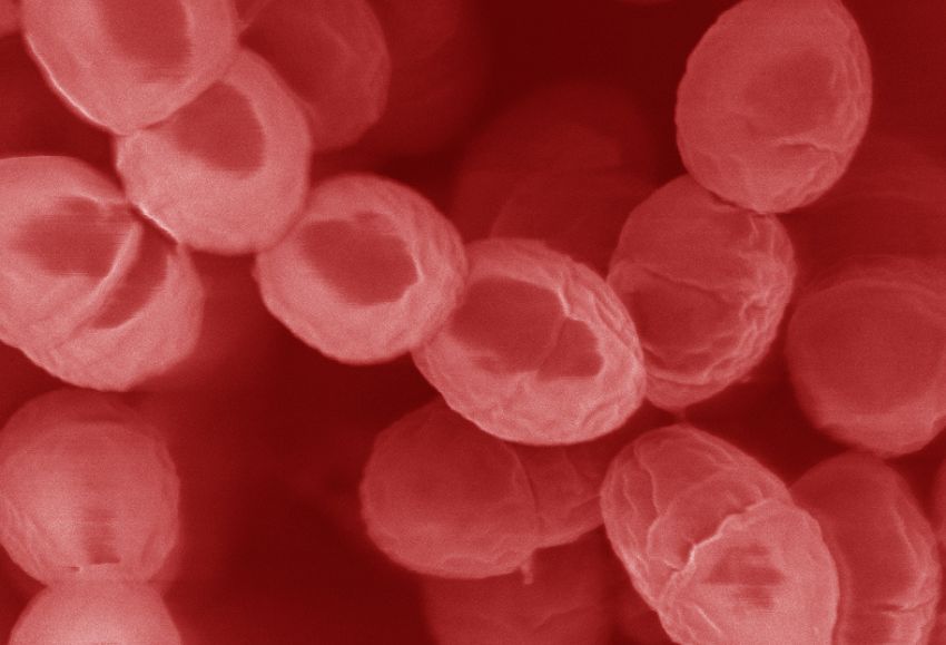 Lactococcus_lactis